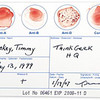 DIY Blood Typing Test